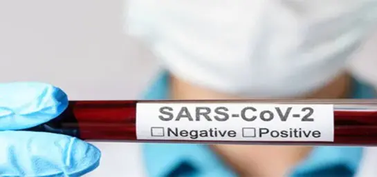 ¿Qué es el nuevo Coronavirus SARS-COV-2?